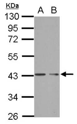 Western Blot: PHF7 Antibody [NBP2-19800]