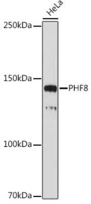 Western Blot: PHF8 Antibody (2H9D4) [NBP3-15910]