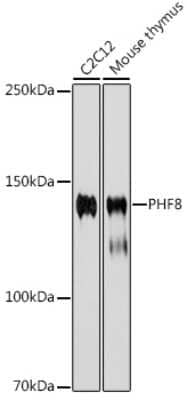 Western Blot: PHF8 Antibody (2H9D4) [NBP3-15910]