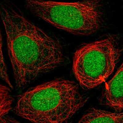 Immunocytochemistry/ Immunofluorescence: PHF8 Antibody [NBP2-56147]