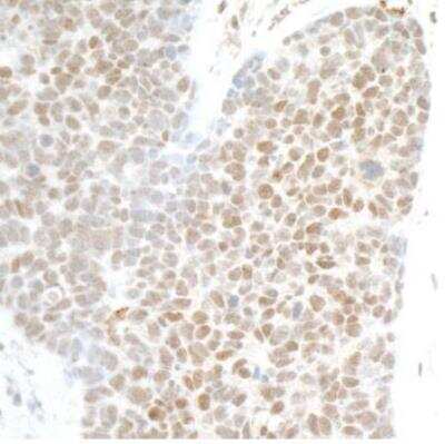 Immunohistochemistry-Paraffin: PHF8 Antibody [NB100-93313]