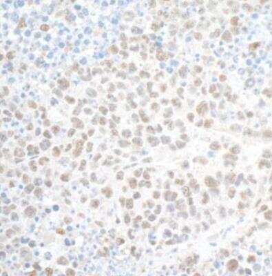 Immunohistochemistry-Paraffin: PHF8 Antibody [NB100-93313]