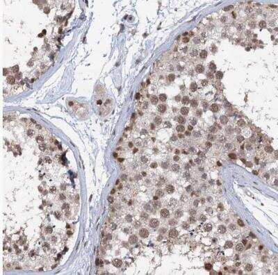 Immunohistochemistry-Paraffin: PHF8 Antibody [NBP1-83079]