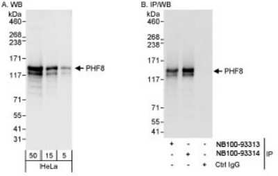 Western Blot: PHF8 Antibody [NB100-93313]