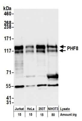 Western Blot: PHF8 Antibody [NB100-93313]