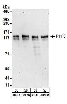 Western Blot: PHF8 Antibody [NB100-93314]