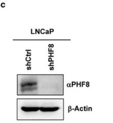 Knockdown Validated: PHF8 Antibody [NB100-93314]