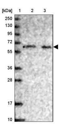 Western Blot: PHF8 Antibody [NBP1-83079]