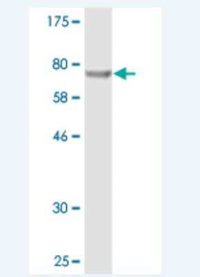 Western Blot: PHGDH Antibody (4D5-1F11) [H00026227-M02]