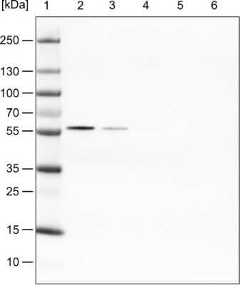 Western Blot: PHGDH Antibody (CL0555) [NBP2-52939]
