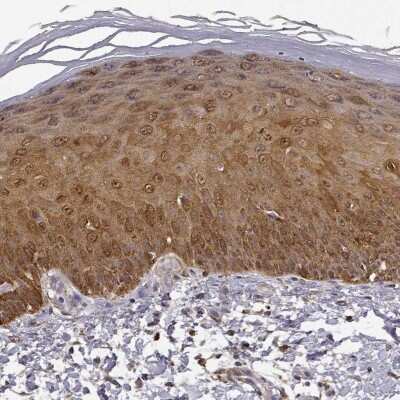 Immunohistochemistry-Paraffin: PHGDH Antibody [NBP1-87311]