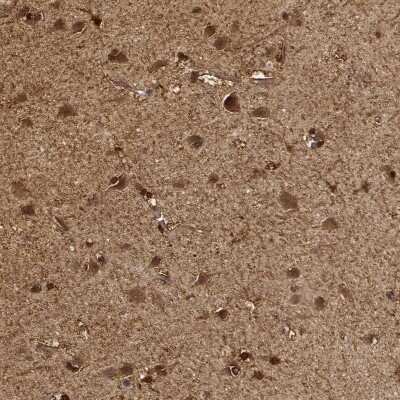 Immunohistochemistry-Paraffin: PHGDH Antibody [NBP1-87311]