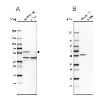 Western Blot: PHGDH Antibody [NBP1-87310]