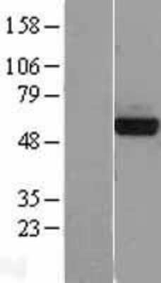 Western Blot: PHGDH Overexpression Lysate [NBL1-14363]