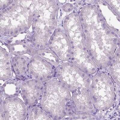 Immunohistochemistry-Paraffin: PHGR1 Antibody [NBP2-49569]
