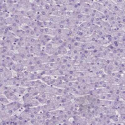 Immunohistochemistry-Paraffin: PHGR1 Antibody [NBP2-49569]