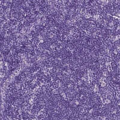 Immunohistochemistry-Paraffin: PHGR1 Antibody [NBP2-49569]
