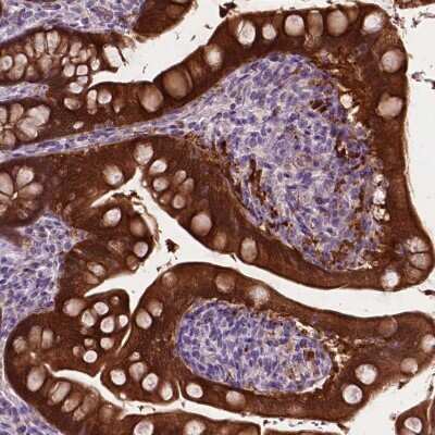 Immunohistochemistry-Paraffin: PHGR1 Antibody [NBP2-49569]