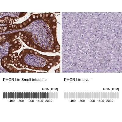 Immunohistochemistry-Paraffin: PHGR1 Antibody [NBP2-49569]