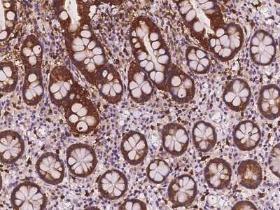 Immunohistochemistry-Paraffin: PHGR1 Antibody [NBP2-98121]