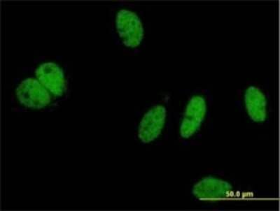 Immunocytochemistry/ Immunofluorescence: PHIP Antibody (4D7) [H00055023-M01]