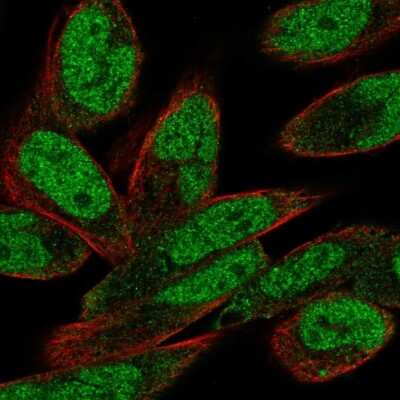 Immunocytochemistry/ Immunofluorescence: PHIP Antibody [NBP2-33886]