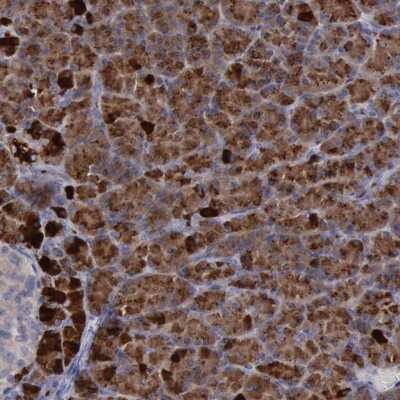 Immunohistochemistry-Paraffin: PHKA1 Antibody [NBP1-87281]