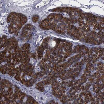 Immunohistochemistry-Paraffin: PHKA1 Antibody [NBP1-87281]