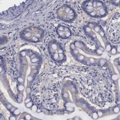Immunohistochemistry-Paraffin: PHKA1 Antibody [NBP1-87281]