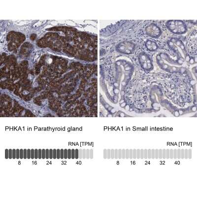 Immunohistochemistry-Paraffin: PHKA1 Antibody [NBP1-87281]