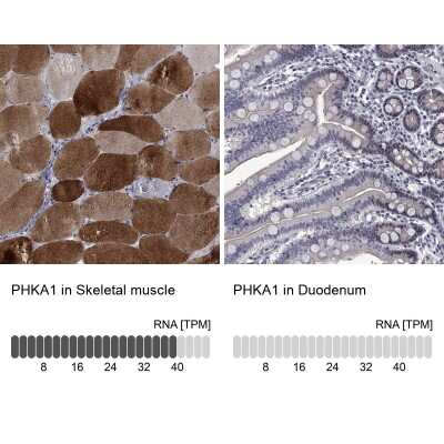 Immunohistochemistry-Paraffin: PHKA1 Antibody [NBP3-17109]