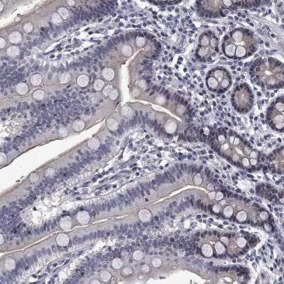 Immunohistochemistry-Paraffin: PHKA1 Antibody [NBP3-17109]