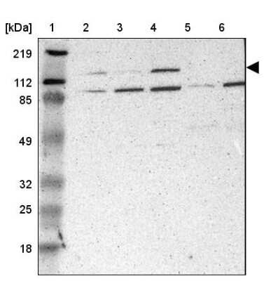 Western Blot: PHKA1 Antibody [NBP1-87281]