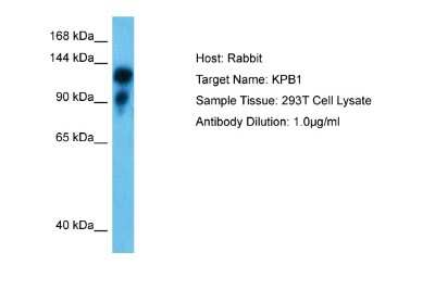 Western Blot: PHKA1 Antibody [NBP2-83392]