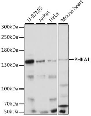 Western Blot: PHKA1 AntibodyAzide and BSA Free [NBP2-93393]