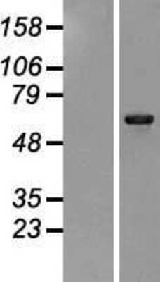 Western Blot: PHKA1 Overexpression Lysate [NBP2-08089]