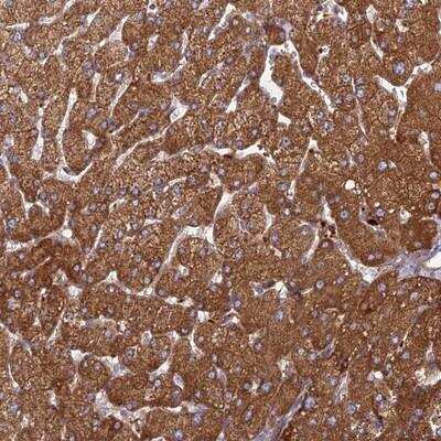 Immunohistochemistry: PHKA2 Antibody [NBP1-92264]