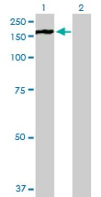 Western Blot: PHKA2 Antibody [H00005256-B01P]