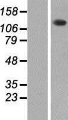 Western Blot: PHKA2 Overexpression Lysate [NBP2-09040]