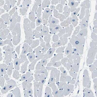 Immunohistochemistry-Paraffin: PHKG1 Antibody [NBP1-87280]