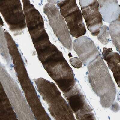 Immunohistochemistry-Paraffin: PHKG1 Antibody [NBP1-87280]