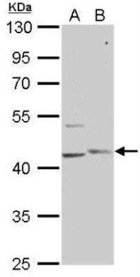 Western Blot: PHKG1 Antibody [NBP1-31548]