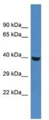 Western Blot: PHKG1 Antibody [NBP1-79637]