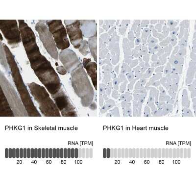 Immunohistochemistry-Paraffin: PHKG1 Antibody [NBP1-87280]
