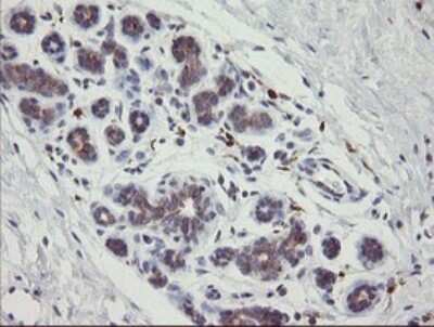 Immunohistochemistry: PHKG2 Antibody (OTI1F9) [NBP2-46393]