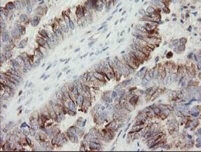 Immunohistochemistry: PHKG2 Antibody (OTI1F9) [NBP2-46393]