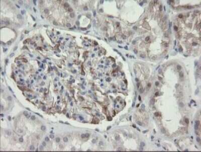 Immunohistochemistry: PHKG2 Antibody (OTI1F9) [NBP2-46393]