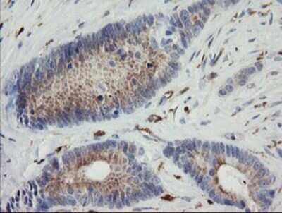 Immunohistochemistry: PHKG2 Antibody (OTI1F9) [NBP2-46393]