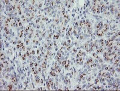 Immunohistochemistry: PHKG2 Antibody (OTI1F9) [NBP2-46393]
