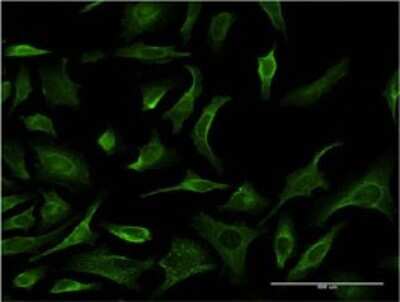 Immunocytochemistry/ Immunofluorescence: PHKG2 Antibody (2B8) [H00005261-M05]